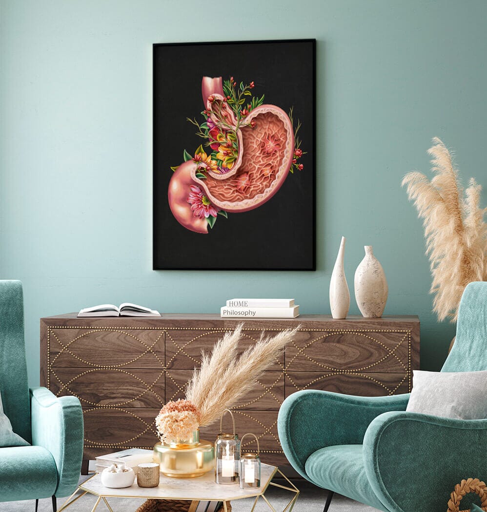 Gastric ulcers anatomy art print by Codex Anatomicus