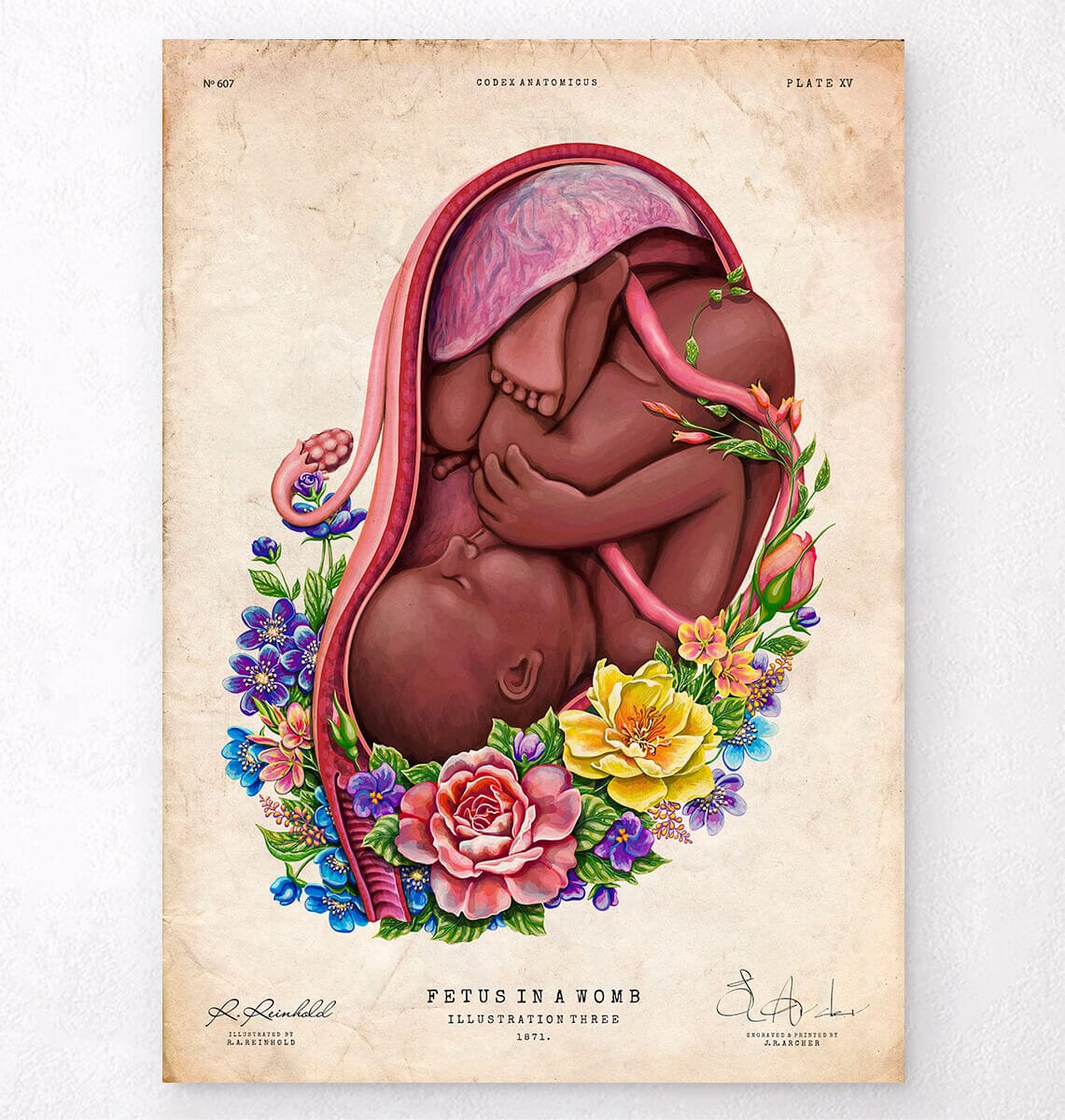 Fetus in a womb anatomy art print - Codex Anatomicus