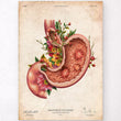 Load image into Gallery viewer, Gastric ulcers anatomy poster
