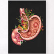 Charger l'image dans la galerie, gastric ulcers anatomy poster
