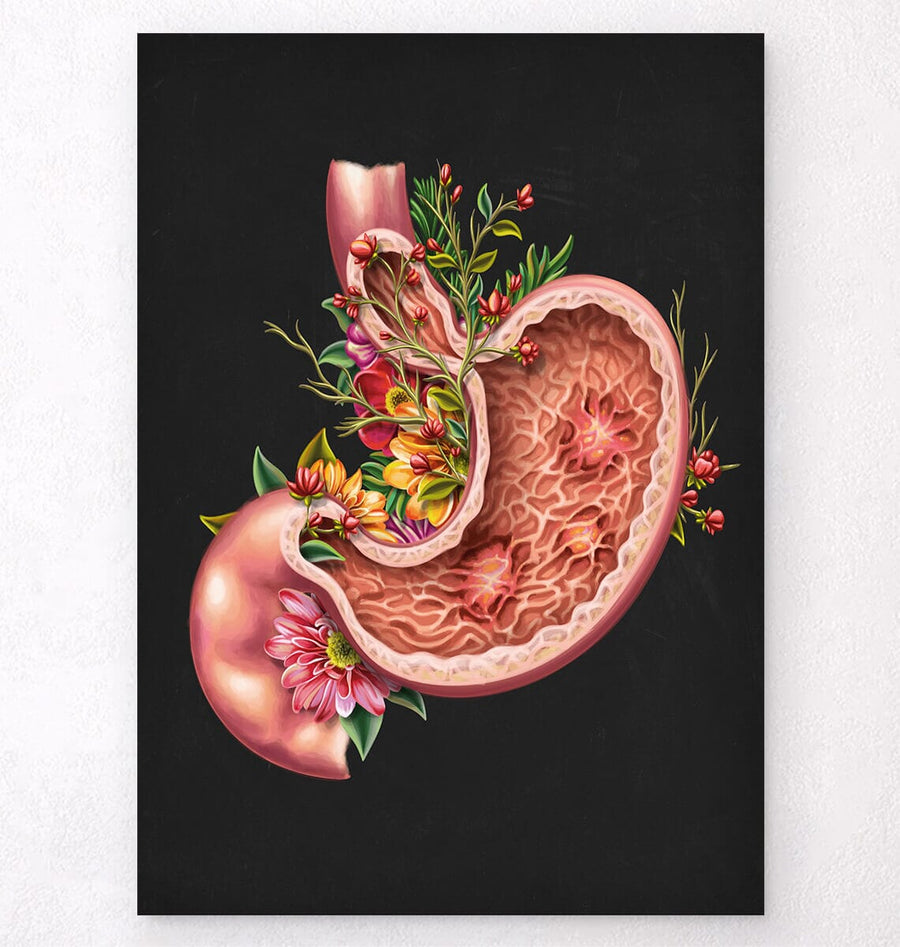 Gastric ulcers anatomy art print by Codex Anatomicus