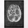 Charger l'image dans la galerie, Brain anatomy art
