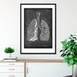 Charger l'image dans la galerie, lungs chalkboard anatomy poster by codex anatomicus
