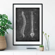 Charger l'image dans la galerie, Spine anatomy poster in Chalkboard Style by Codex Anatomicus
