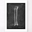 Load image into Gallery viewer, Tibia and fibula anatomy art print
