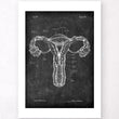 Charger l'image dans la galerie, Anatomie de l'utérus - Chalkboard
